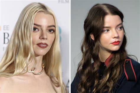 anya taylor joy eye condition|anya taylor joy eyes far apart.